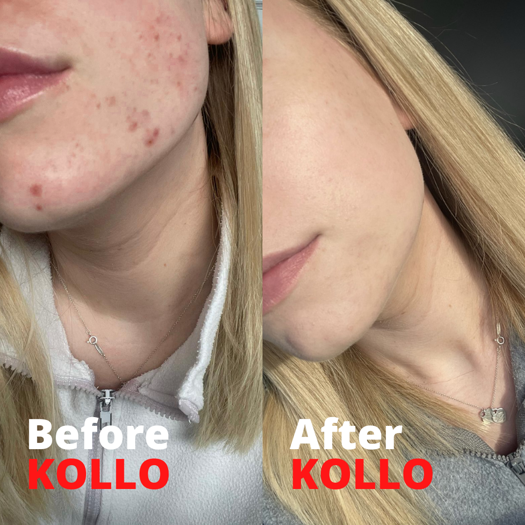 Melissa's Story