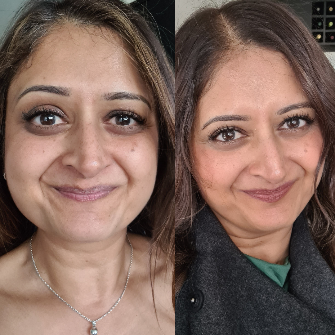 Asha's Story