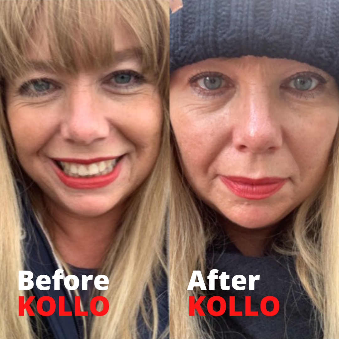 Kirsteen's Story