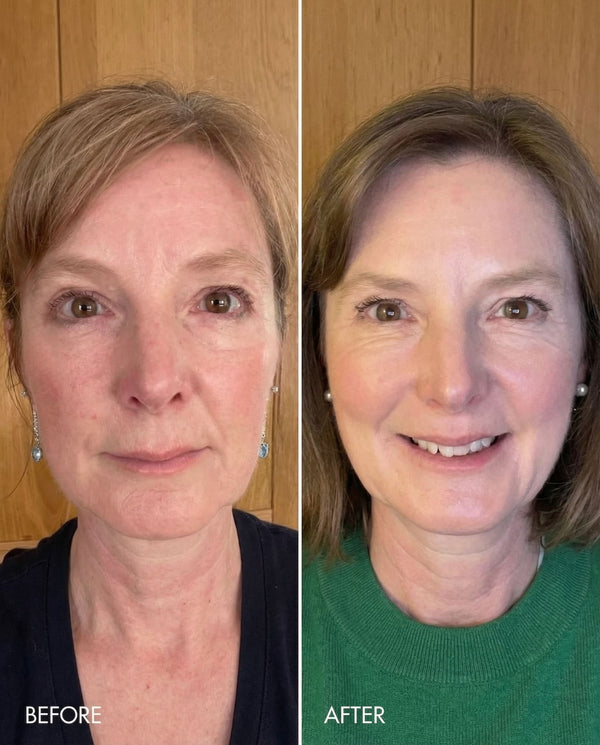 Kollo customer results