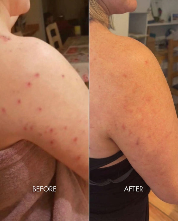 Kollo customer results