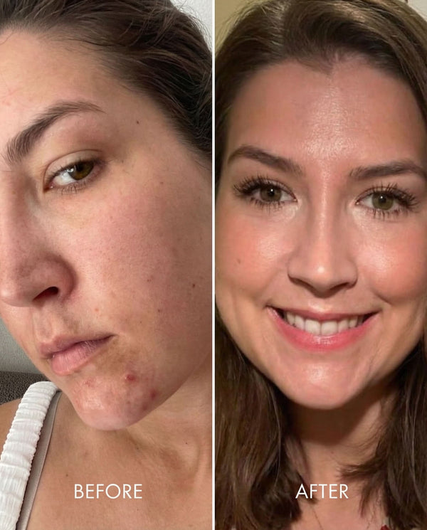 Results 05