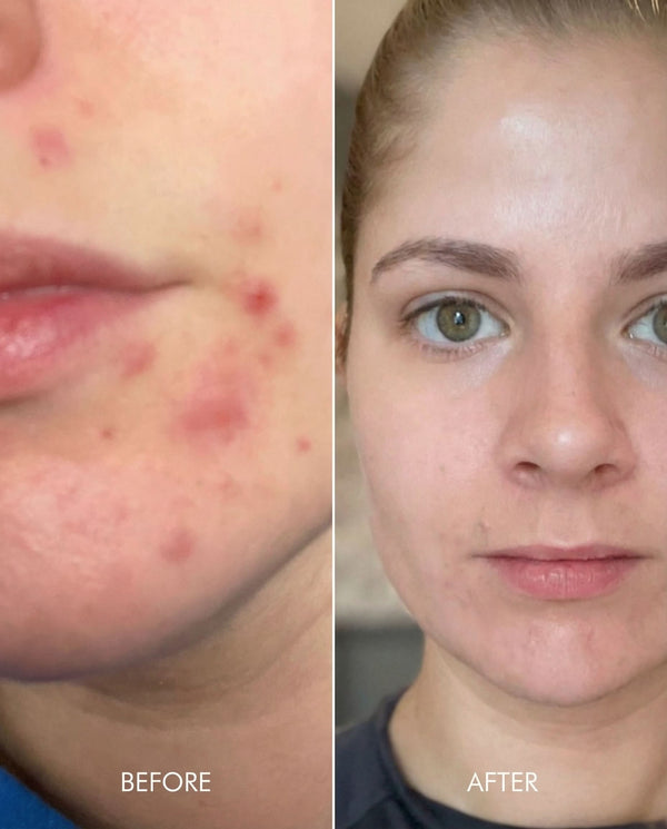 Kollo customer results